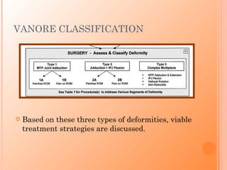 VANORE CLASSIFICATION




   Based on these three types of deformities, viable
    treatment strategies are discussed.
 