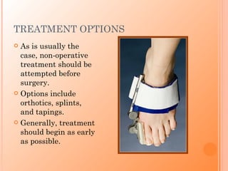 TREATMENT OPTIONS
 As is usually the
  case, non-operative
  treatment should be
  attempted before
  surgery.
 Options include
  orthotics, splints,
  and tapings.
 Generally, treatment
  should begin as early
  as possible.
 