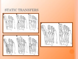 STATIC TRANSFERS
 