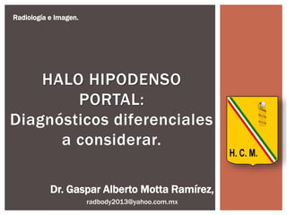 HALO HIPODENSO
PORTAL:
Diagnósticos diferenciales
a considerar.
Radiología e Imagen.
Dr. Gaspar Alberto Motta Ramírez,
radbody2013@yahoo.com.mx
 