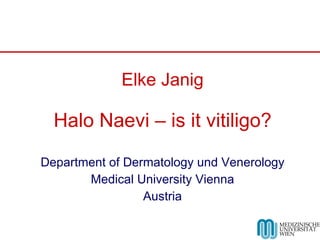 Elke Janig Halo Naevi – is it vitiligo? Department of Dermatology und Venerology Medical University Vienna Austria 