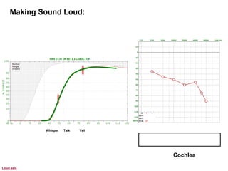 Making Sound Loud:
Whisper Talk Yell
Cochlea
Loud.axis
 