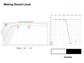 Making Sound Loud:
Whisper Talk Yell
Cochlea
 