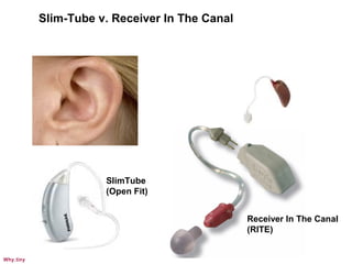 Receiver In The Canal
(RITE)
SlimTube
(Open Fit)
Slim-Tube v. Receiver In The Canal
Why.tiny
 