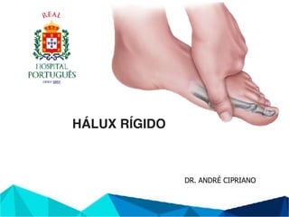 DR. ANDRÉ CIPRIANO
HÁLUX RÍGIDO
 