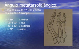 Ângulo metatarsofalângico:
• Linha no eixo do 1º MTT e linha
no eixo da 1ª falange
– < 15º  normal
– 16º a 19º  leve
– 20º a 39º  moderado
– > 40º  grave
 