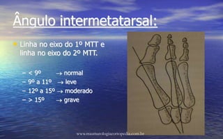 Ângulo intermetatarsal:
• Linha no eixo do 1º MTT e
linha no eixo do 2º MTT.
– < 9º  normal
– 9º a 11º  leve
– 12º a 15º  moderado
– > 15º  grave
www.traumatologiaeortopedia.com.br
 