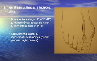 • Em geral são utilizadas 2 incisões:
– Lateral:
• Dorsal entre cabeças 1° e 2° MTT,
p/ transferência adutor do hálux
p/ face lateral colo 1° MTT;
• Capsulotomia lateral p/
reposicionar sesamóides (cuidar
vascularização cabeça)
 