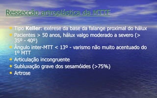 Ressecção artroplástica da MTTF
• Tipo Keller: exérese da base da falange proximal do hálux
• Pacientes > 50 anos, hálux valgo moderado a severo (>
35º - 40º)
• Ângulo inter-MTT < 13º - varismo não muito acentuado do
1º MTT
• Articulação incongruente
• Subluxação grave dos sesamóides (>75%)
• Artrose
 