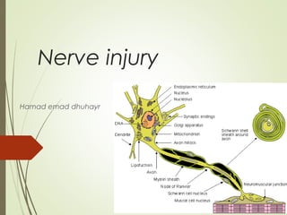 Nerve injury
Hamad emad dhuhayr
Dr Saleh WaslAllah Alharby
www.ksu.edu.sa/DrSalehAlharby
 