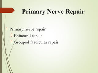 Primary Nerve Repair
 Primary nerve repair
 Epineural repair
 Grouped fascicular repair
 