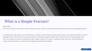 Math Simple Fracture Comprehensive Overview of Simple Fractures and Joint Dislocations ...