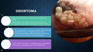 ODONTOMA
The term odontoma was coined by Paul Broca in
1867.
Broca defined the term as tumors formed by the
overgrowth or transitory of complete dental tissue.
In a broad sense, it means a growth with both the
epithelial and mesenchymal components
exhibiting complete differentiation resulting in
functional ameloblasts and odontoblasts.
These cells in turn form variable amounts of enamel
and dentin and pulpal tissue of the odontoma.
 