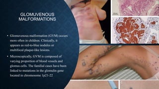 GLOMUVENOUS
MALFORMATIONS
• Glomuvenous malformation (GVM) occurs
more often in children. Clinically, it
appears as red-to-blue nodules or
multifocal plaque-like lesions.
• Microscopically, GVM is composed of
varying proportion of blood vessels and
glomus cells. The familial cases have been
linked to mutations in the glomulin gene
located in chromosome 1p21-22
 