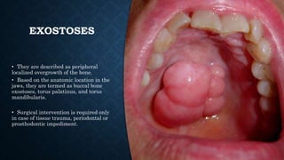 EXOSTOSES
• They are described as peripheral
localized overgrowth of the bone.
• Based on the anatomic location in the
jaws, they are termed as buccal bone
exostoses, torus palatinus, and torus
mandibularis.
• Surgical intervention is required only
in case of tissue trauma, periodontal or
prosthodontic impediment.
 