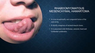 RHABDOMYOMATOUS
MESENCHYMAL HAMARTOMA
• It is an exceptionally rare congenital lesion of the
oral cavity.
• It chiefly comprises of striated muscle tissue.
• It is associated with Delleman, amniotic band and
Goldenhar syndromes.
 