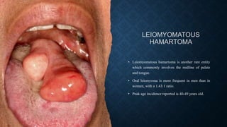 LEIOMYOMATOUS
HAMARTOMA
• Leiomyomatous hamartoma is another rare entity
which commonly involves the midline of palate
and tongue.
• Oral leiomyoma is more frequent in men than in
women, with a 1.43:1 ratio.
• Peak age incidence reported is 40-49 years old.
 