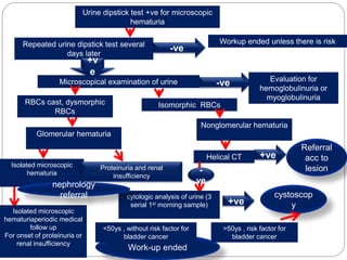 Work-up ended
Urine dipstick test +ve for microscopic
hematuria
Repeated urine dipstick test several
days later
Workup ended unless there is risk
factors-ve
+v
e
Microscopical examination of urine -ve Evaluation for
hemoglobulinuria or
myoglobulinuria
RBCs cast, dysmorphic
RBCs
Isomorphic RBCs
Glomerular hematuria
Nonglomerular hematuria
Isolated microscopic
hematuria
Isolated microscopic
hematuriaperiodic medical
follow up
For onset of proteinuria or
renal insufficiency
Proteinuria and renal
insufficiency
Helical CT +ve
Referral
acc to
lesion-
ve
cytologic analysis of urine (3
serial 1st morning sample) +ve
cystoscop
y
nephrology
referral
>50ys , risk factor for
bladder cancer
<50ys , without risk factor for
bladder cancer
 