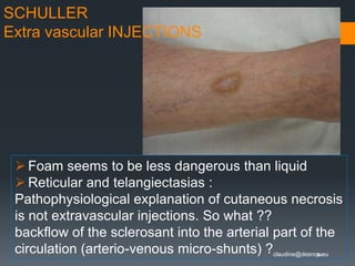 Extravascular Injection How to use sclerotherapy successfully to cure telangiectasia and ...