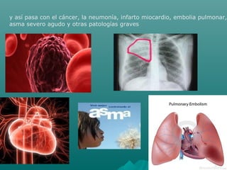 y así pasa con el cáncer, la neumonía, infarto miocardio, embolia pulmonar,
asma severo agudo y otras patologías graves
 