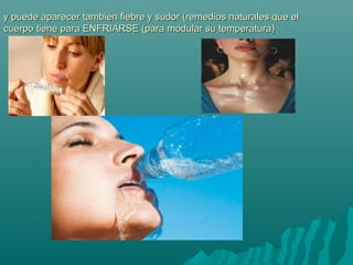 y puede aparecer también fiebre y sudor (remedios naturales que ely puede aparecer también fiebre y sudor (remedios naturales que el
cuerpo tiene para ENFRIARSE (para modular su temperatura)cuerpo tiene para ENFRIARSE (para modular su temperatura)
 