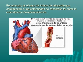 Por ejemplo, es el caso del infarto de miocardio quePor ejemplo, es el caso del infarto de miocardio que
corresponde a una enfermedad no cancerosa tal como locorresponde a una enfermedad no cancerosa tal como lo
entendemos convencionalmente,entendemos convencionalmente,
 