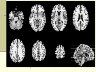 Brain activations of “selfing” - Gillihan, et al., Psych Bulletin, 1/2005 