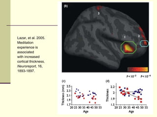 Lazar, et al. 2005.  Meditation  experience is  associated with increased cortical thickness. Neuroreport , 16, 1893-1897. 