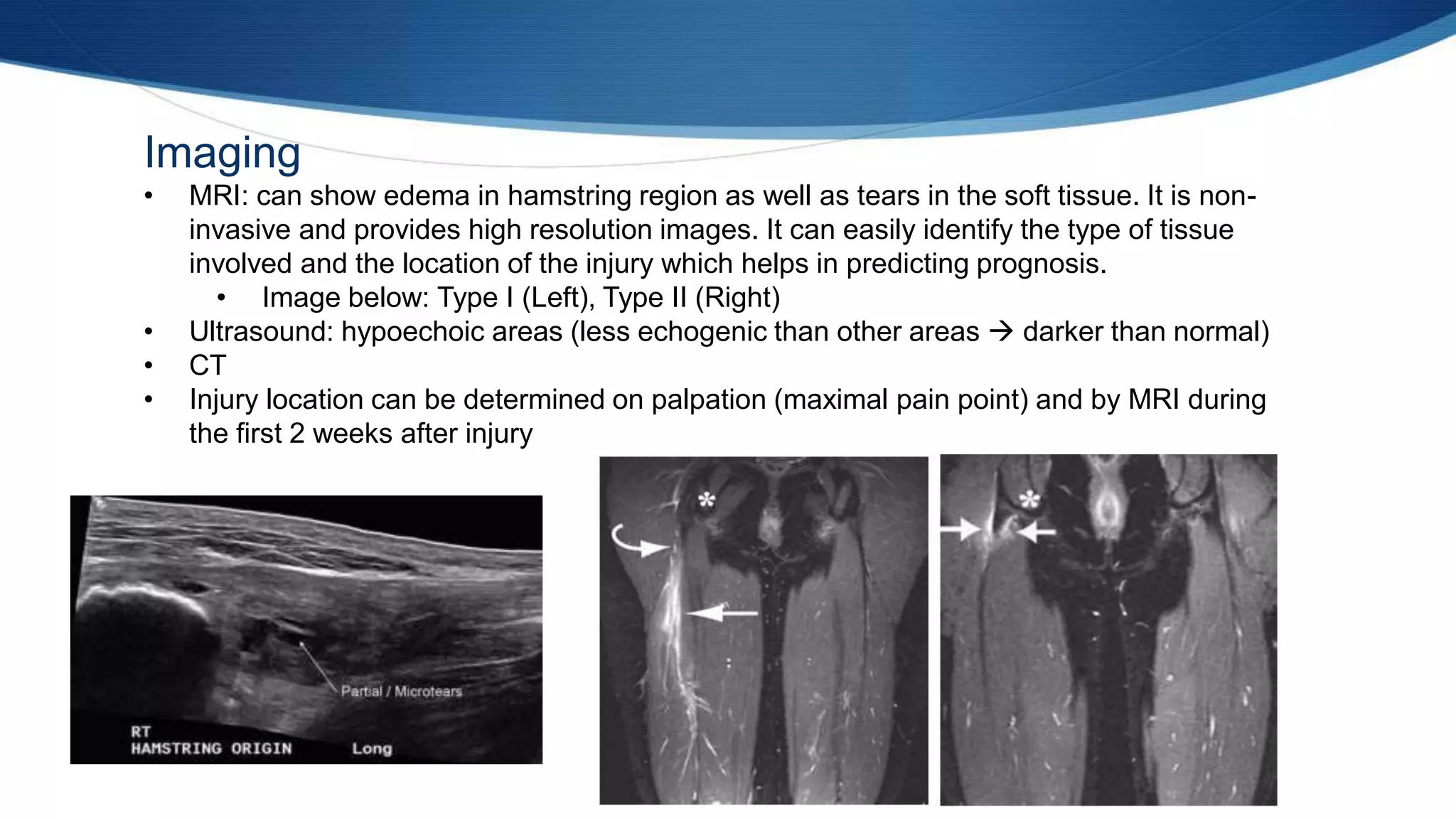 Imaging
• MRI: can show edema in hamstring region as well as tears in the soft tissue. It is non-
invasive and provides high resolution images. It can easily identify the type of tissue
involved and the location of the injury which helps in predicting prognosis.
• Image below: Type I (Left), Type II (Right)
• Ultrasound: hypoechoic areas (less echogenic than other areas  darker than normal)
• CT
• Injury location can be determined on palpation (maximal pain point) and by MRI during
the first 2 weeks after injury
 