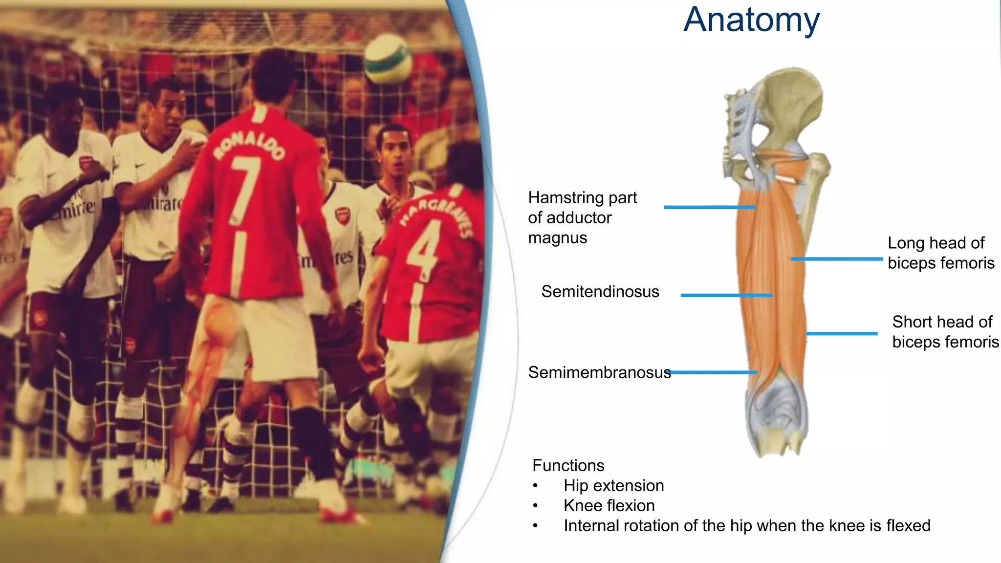 Anatomy
Hamstring part
of adductor
magnus Long head of
biceps femoris
Short head of
biceps femoris
Semitendinosus
Semimembranosus
Functions
• Hip extension
• Knee flexion
• Internal rotation of the hip when the knee is flexed
 