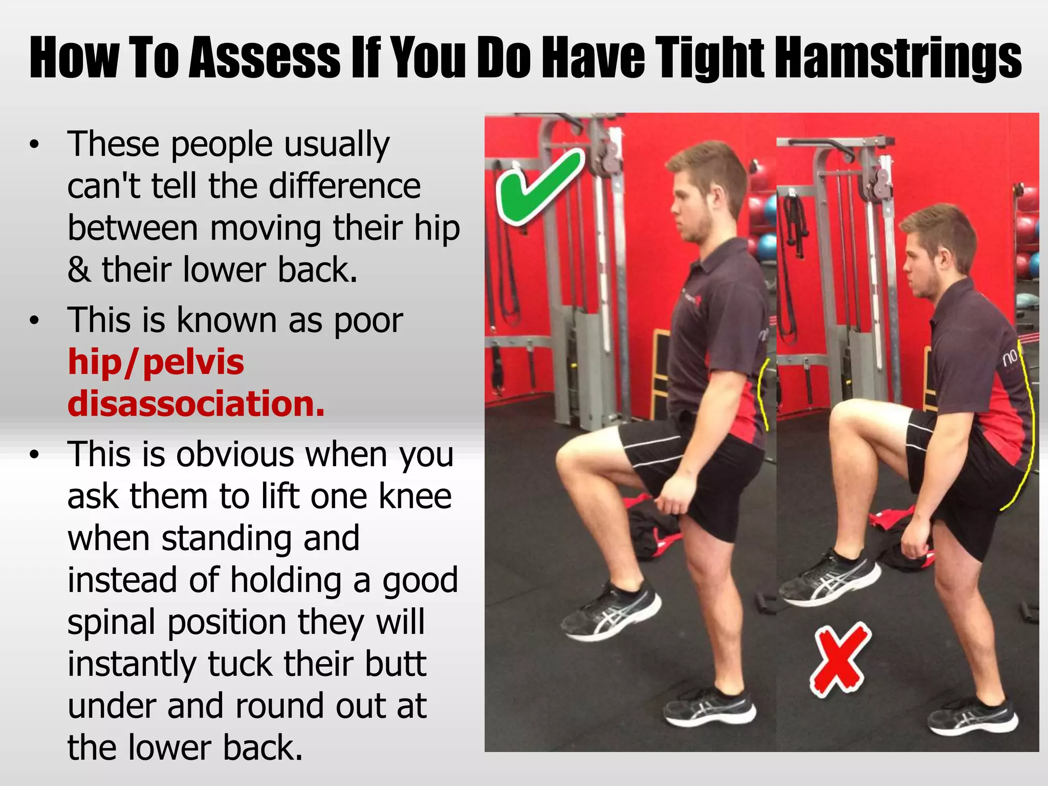 How To Assess If You Do Have Tight Hamstrings
• These people usually
can't tell the difference
between moving their hip
& their lower back.
• This is known as poor
hip/pelvis
disassociation.
• This is obvious when you
ask them to lift one knee
when standing and
instead of holding a good
spinal position they will
instantly tuck their butt
under and round out at
the lower back.
 