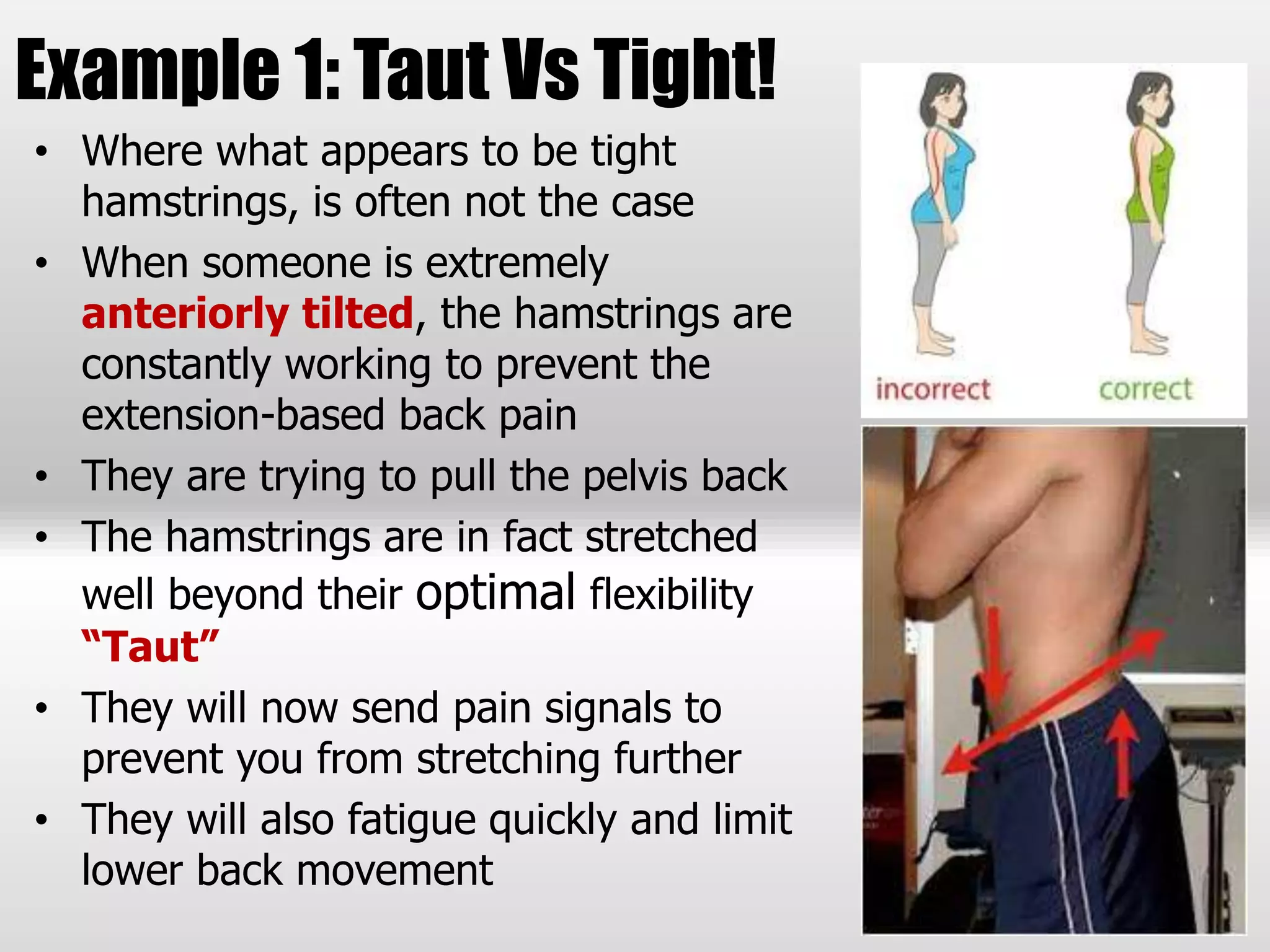 Example 1: Taut Vs Tight!
• Where what appears to be tight
hamstrings, is often not the case
• When someone is extremely
anteriorly tilted, the hamstrings are
constantly working to prevent the
extension-based back pain
• They are trying to pull the pelvis back
• The hamstrings are in fact stretched
well beyond their optimal flexibility
“Taut”
• They will now send pain signals to
prevent you from stretching further
• They will also fatigue quickly and limit
lower back movement
 