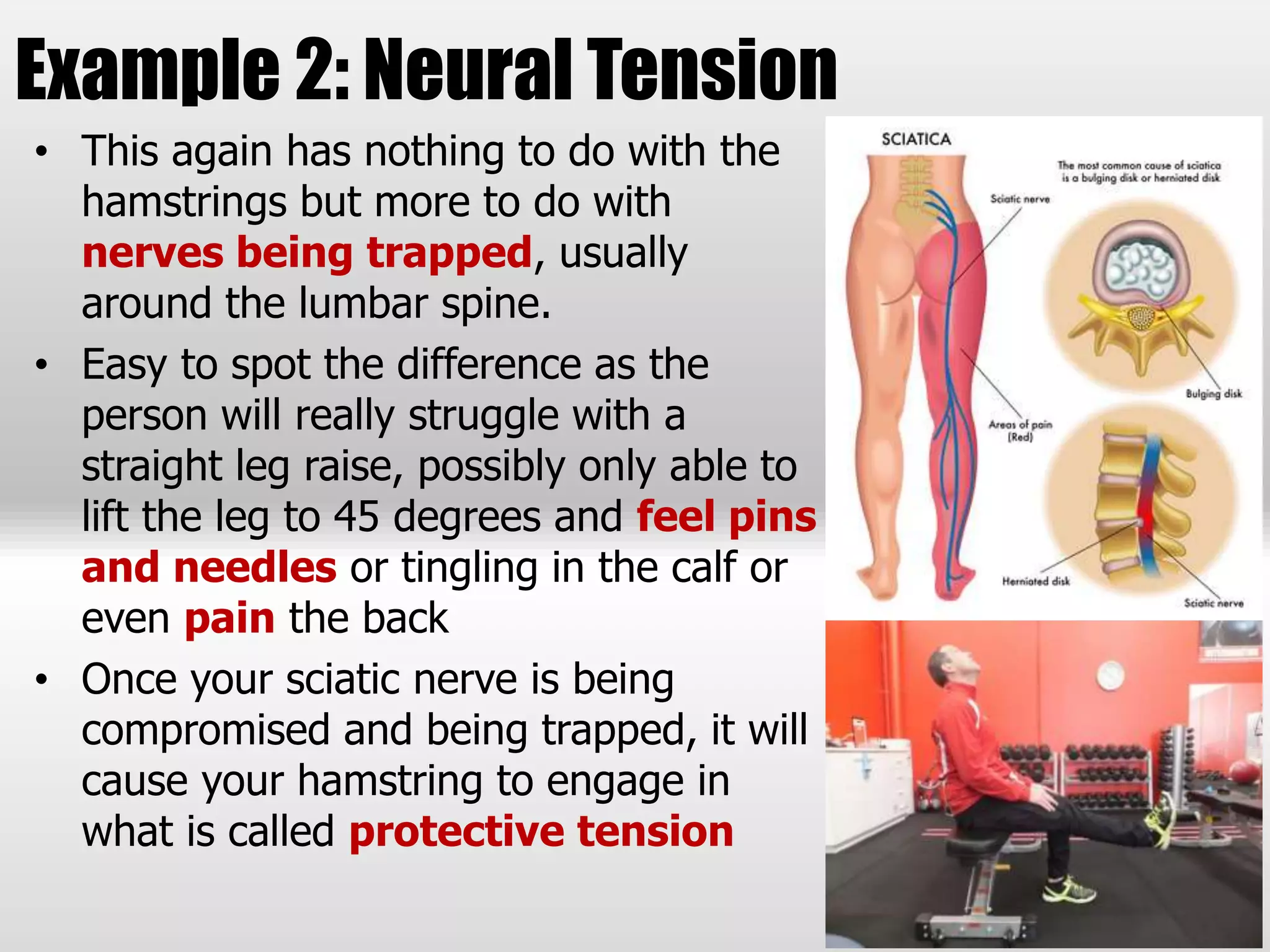 Example 2: Neural Tension
• This again has nothing to do with the
hamstrings but more to do with
nerves being trapped, usually
around the lumbar spine.
• Easy to spot the difference as the
person will really struggle with a
straight leg raise, possibly only able to
lift the leg to 45 degrees and feel pins
and needles or tingling in the calf or
even pain the back
• Once your sciatic nerve is being
compromised and being trapped, it will
cause your hamstring to engage in
what is called protective tension
 