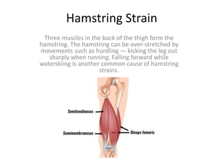 Hamstring Strain
Three muscles in the back of the thigh form the
hamstring. The hamstring can be over-stretched by
movements such as hurdling — kicking the leg out
sharply when running. Falling forward while
waterskiing is another common cause of hamstring
strains.
 