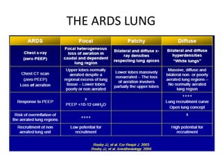 THE ARDS LUNG
 