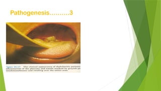 Pathogenesis……….3
 