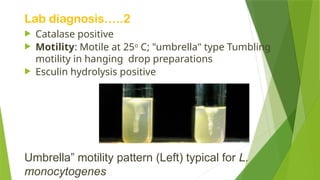 Lab diagnosis…..2
 Catalase positive
 Motility: Motile at 25o
C; "umbrella" type Tumbling
motility in hanging drop preparations
 Esculin hydrolysis positive
Umbrella” motility pattern (Left) typical for L.
monocytogenes
 