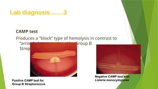 Lab diagnosis…….3
CAMP test
Produces a “block” type of hemolysis in contrast to
“arrow”-shape produced by Group B
Streptococcus
Negative CAMP test with
Listeria monocytogenes
Positive CAMP test for
Group B Streptococcus
 