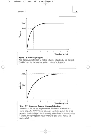 Spirometry 5
Time (seconds)
FVC
FEV1
Volume
0 1 2 3 4 5 6
Figure 1.1 Normal spirogram
Note that approximately 80% of the total volume is exhaled in the first 1 second
(the FEV1) and that the curve has reached a plateau by 6 seconds.
Time (seconds)
FVC
FEV1
0 1 2 3 4 5 6
Volume
Figure 1.2 Spirogram showing airways obstruction
Both the FEV1 and the FVC may be reduced, but the FEV1 is reduced to a
greater extent. The FEV1/FVC ratio is therefore low. In this patient, the forced
expiratory time is prolonged and a convincing plateau has not been reached by
6 seconds. Ideally, the patient should continue to blow until a plateau has
been reached.
Ch 1 Hancox 6/10/05 10:38 AM Page 5
 