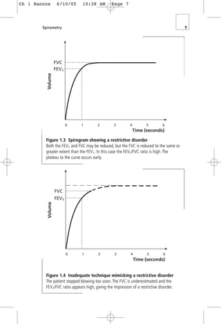 Spirometry 7
Figure 1.3 Spirogram showing a restrictive disorder
Both the FEV1 and FVC may be reduced, but the FVC is reduced to the same or
greater extent than the FEV1. In this case the FEV1/FVC ratio is high. The
plateau to the curve occurs early.
Time (seconds)
FVC
FEV1
0 1 2 3 4 5 6
Volume
Time (seconds)
FVC
FEV1
0 1 2 3 4 5 6
Volume
Figure 1.4 Inadequate technique mimicking a restrictive disorder
The patient stopped blowing too soon. The FVC is underestimated and the
FEV1/FVC ratio appears high, giving the impression of a restrictive disorder.
Ch 1 Hancox 6/10/05 10:38 AM Page 7
 