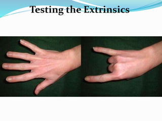 Tendon Testing Hand Tendon injuries of hand | PPTX