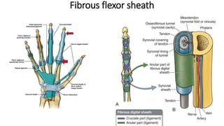 Fibrous flexor sheath
 