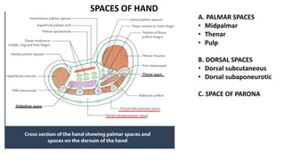SPACES OF HAND
A. PALMAR SPACES
• Midpalmar
• Thenar
• Pulp
B. DORSAL SPACES
• Dorsal subcutaneous
• Dorsal subaponeurotic
C. SPACE OF PARONA
 