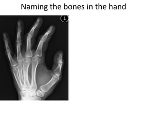 Naming the bones in the hand
 
