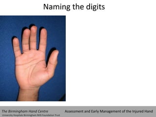 Naming the digits
The Birmingham Hand Centre Assessment and Early Management of the Injured Hand
University Hospitals Birmingham NHS Foundation Trust
 