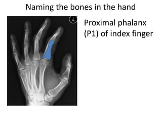 Naming the bones in the hand
Proximal phalanx
(P1) of index finger
 