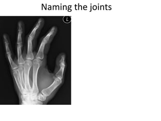 Naming the joints
 