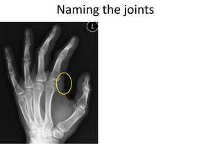Naming the joints
 