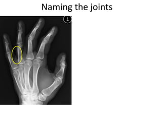 Naming the joints
 