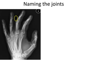 Naming the joints
 